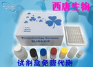 西唐生物软骨糖蛋白39(YKL-40)试剂盒 免费代测