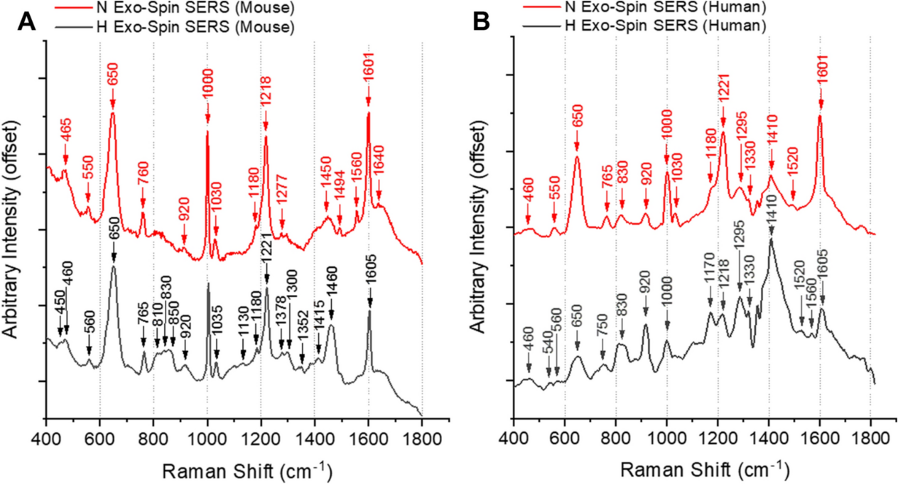 Scientific Reports：使用单外泌体表征分析技术与蛋白组学检测乏氧状态的肾细胞癌外泌体