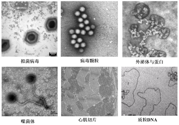 低電壓、無負染，以“柔”克剛！脂質體、囊泡成像福音，生物型透射電鏡LVEM