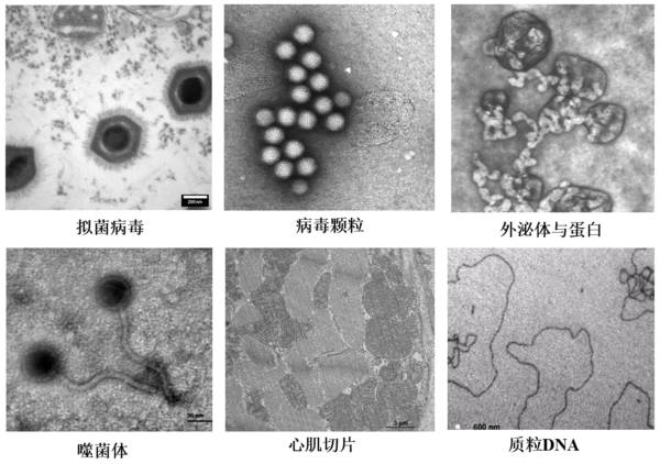 低电压、无负染，以“柔”克刚！脂质体、囊泡成像福音，生物型透射电镜LVEM