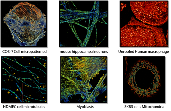 显微镜界的“黑科技”：3D超分辨成像系统